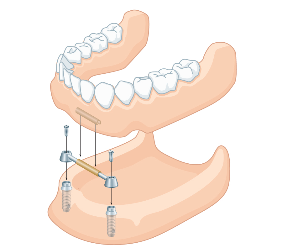 Conceptual Medical/Dental Illustration